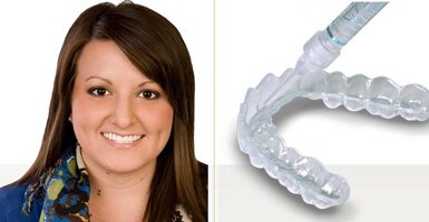 Bleaching Tray for tooth whitening with Dr Allan Melnick, Denitst in Encino, CA