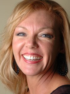 Joyce, Porcelain veneers