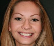 Preventative Dentistry is important to dentist Dr Allan Melnick