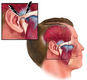 Encino dentist Dr Allan Melnick can answer questions about TMJ disorders.