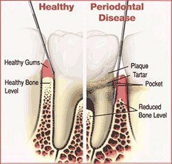 Periodontal work